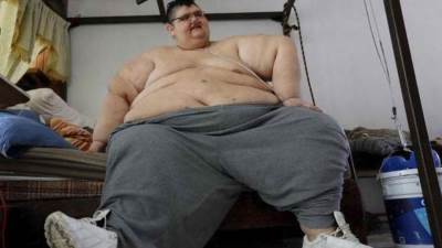 "أسمن رجل في العالم" ينجح في التغلب على كورونا